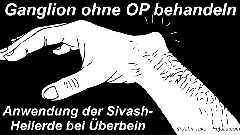 Ganglion ohne Operation mit Heilerde natürlich behandeln