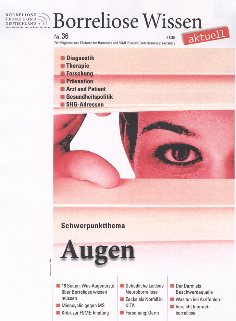 Borreliose und die Folgen für die Augen