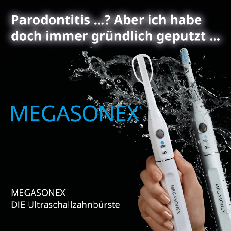 Parodontitis…?